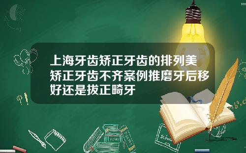 上海牙齿矫正牙齿的排列美矫正牙齿不齐案例推磨牙后移好还是拔正畸牙