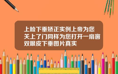 上睑下垂矫正实例上帝为您关上了门同样为您打开一扇窗双眼皮下垂图片真实