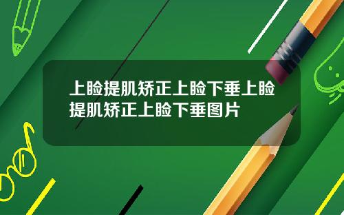 上睑提肌矫正上睑下垂上睑提肌矫正上睑下垂图片