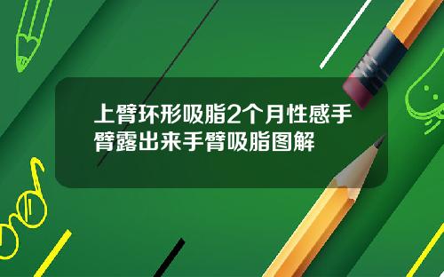 上臂环形吸脂2个月性感手臂露出来手臂吸脂图解