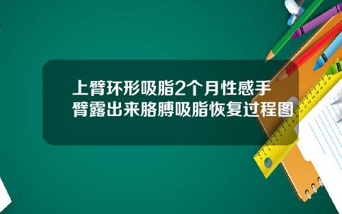 上臂环形吸脂2个月性感手臂露出来胳膊吸脂恢复过程图