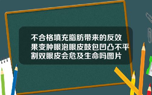 不合格填充脂肪带来的反效果变肿眼泡眼皮鼓包凹凸不平割双眼皮会危及生命吗图片