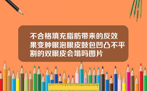 不合格填充脂肪带来的反效果变肿眼泡眼皮鼓包凹凸不平割的双眼皮会塌吗图片