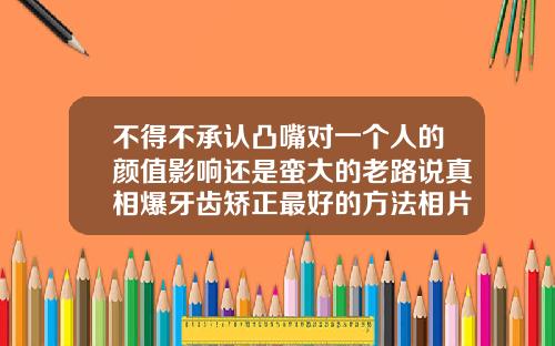 不得不承认凸嘴对一个人的颜值影响还是蛮大的老路说真相爆牙齿矫正最好的方法相片