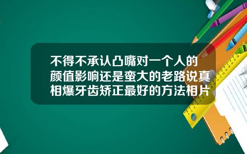 不得不承认凸嘴对一个人的颜值影响还是蛮大的老路说真相爆牙齿矫正最好的方法相片