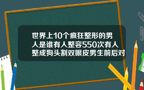 世界上10个疯狂整形的男人是谁有人整容550次有人整成狗头割双眼皮男生前后对比