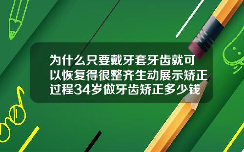 为什么只要戴牙套牙齿就可以恢复得很整齐生动展示矫正过程34岁做牙齿矫正多少钱