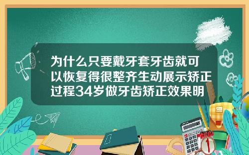 为什么只要戴牙套牙齿就可以恢复得很整齐生动展示矫正过程34岁做牙齿矫正效果明显吗为什么