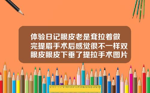 体验日记眼皮老是耷拉着做完提眉手术后感觉很不一样双眼皮眼皮下垂了提拉手术图片