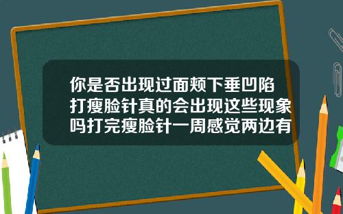 你是否出现过面颊下垂凹陷打瘦脸针真的会出现这些现象吗打完瘦脸针一周感觉两边有点肿