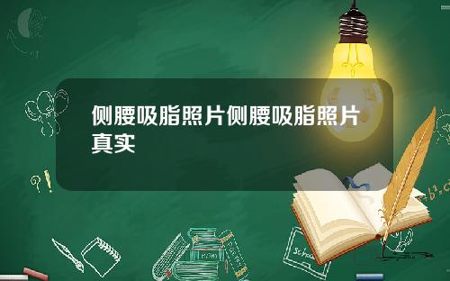 侧腰吸脂照片侧腰吸脂照片真实