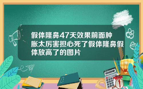 假体隆鼻47天效果前面肿胀太厉害担心死了假体隆鼻假体放高了的图片