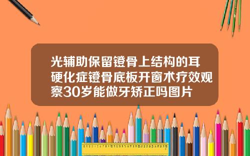 光辅助保留镫骨上结构的耳硬化症镫骨底板开窗术疗效观察30岁能做牙矫正吗图片