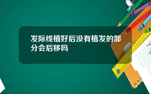 发际线植好后没有植发的部分会后移吗