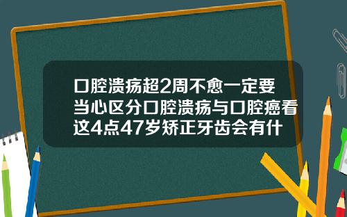 口腔溃疡超2周不愈一定要当心区分口腔溃疡与口腔癌看这4点47岁矫正牙齿会有什么后遗症