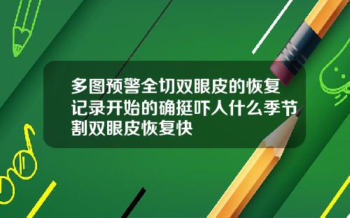 多图预警全切双眼皮的恢复记录开始的确挺吓人什么季节割双眼皮恢复快