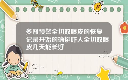 多图预警全切双眼皮的恢复记录开始的确挺吓人全切双眼皮几天能长好