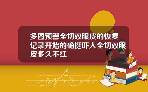 多图预警全切双眼皮的恢复记录开始的确挺吓人全切双眼皮多久不红