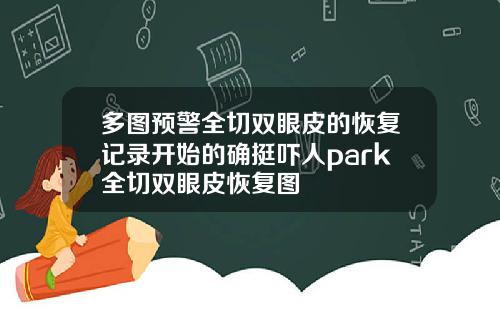 多图预警全切双眼皮的恢复记录开始的确挺吓人park全切双眼皮恢复图