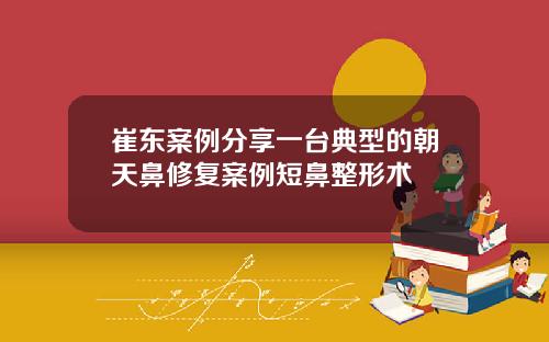 崔东案例分享一台典型的朝天鼻修复案例短鼻整形术