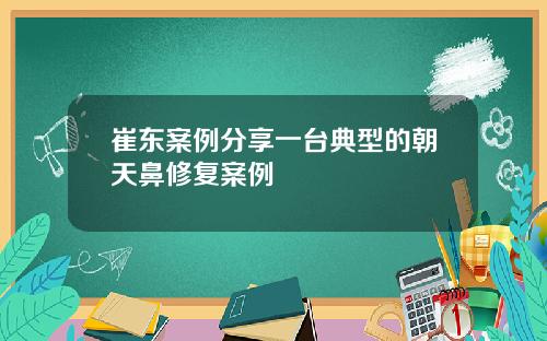 崔东案例分享一台典型的朝天鼻修复案例