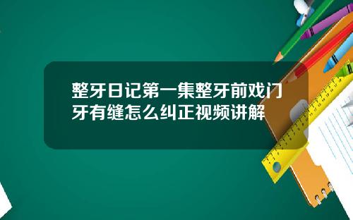 整牙日记第一集整牙前戏门牙有缝怎么纠正视频讲解