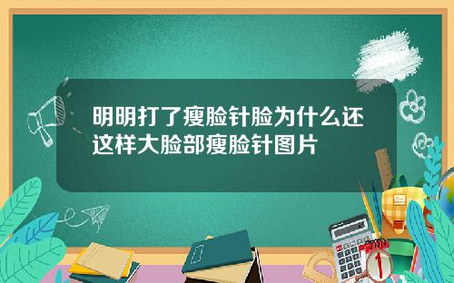 明明打了瘦脸针脸为什么还这样大脸部瘦脸针图片