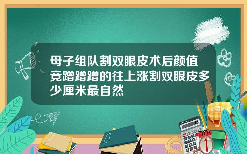 母子组队割双眼皮术后颜值竟蹭蹭蹭的往上涨割双眼皮多少厘米最自然