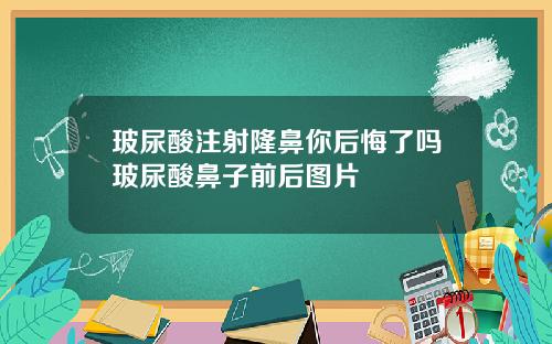 玻尿酸注射隆鼻你后悔了吗玻尿酸鼻子前后图片