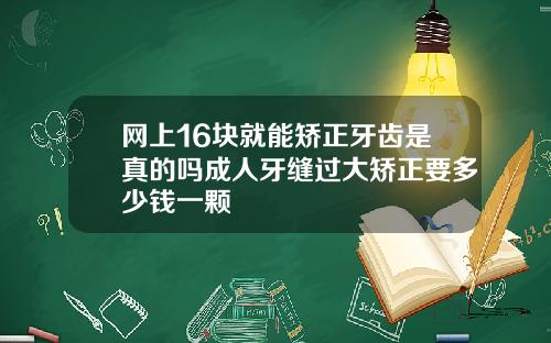 网上16块就能矫正牙齿是真的吗成人牙缝过大矫正要多少钱一颗