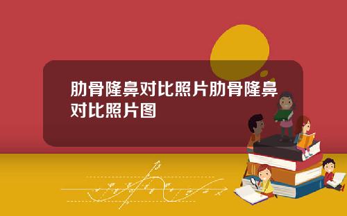 肋骨隆鼻对比照片肋骨隆鼻对比照片图