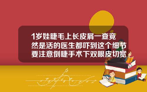 1岁娃睫毛上长皮屑一查竟然是活的医生都吓到这个细节要注意倒睫手术下双眼皮切宽了