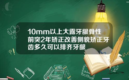10mm以上大露牙龈骨性前突2年矫正改善侧貌矫正牙齿多久可以排齐牙龈