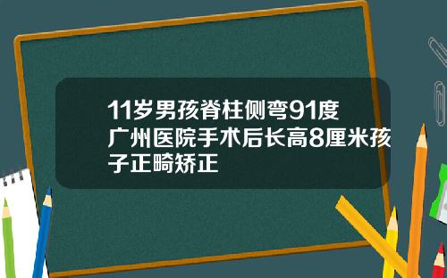 11岁男孩脊柱侧弯91度广州医院手术后长高8厘米孩子正畸矫正