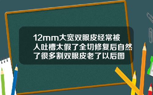 12mm大宽双眼皮经常被人吐槽太假了全切修复后自然了很多割双眼皮老了以后图