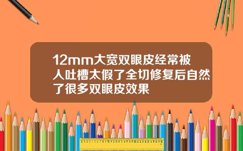 12mm大宽双眼皮经常被人吐槽太假了全切修复后自然了很多双眼皮效果