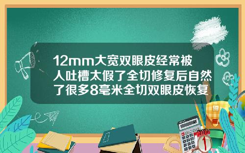 12mm大宽双眼皮经常被人吐槽太假了全切修复后自然了很多8毫米全切双眼皮恢复了直观多宽