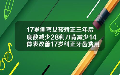 17岁侧弯女孩矫正三年后度数减少28剃刀背减少14体表改善17岁纠正牙齿费用