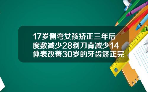 17岁侧弯女孩矫正三年后度数减少28剃刀背减少14体表改善30岁的牙齿矫正完牙齿多久可以看出效果