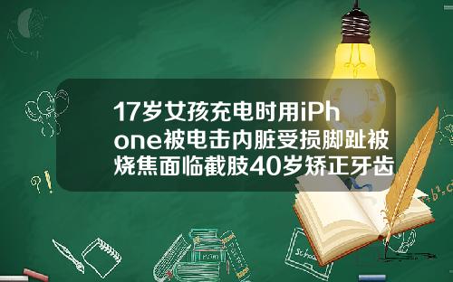 17岁女孩充电时用iPhone被电击内脏受损脚趾被烧焦面临截肢40岁矫正牙齿有什么后遗症吗视频
