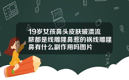 19岁女孩鼻头皮肤破溃流脓都是线雕隆鼻惹的祸线雕隆鼻有什么副作用吗图片