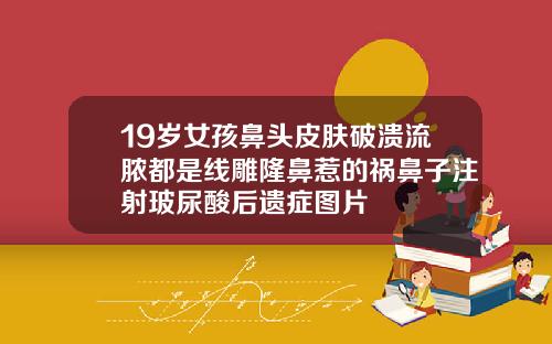 19岁女孩鼻头皮肤破溃流脓都是线雕隆鼻惹的祸鼻子注射玻尿酸后遗症图片