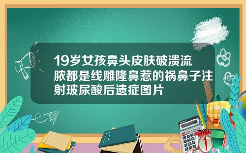 19岁女孩鼻头皮肤破溃流脓都是线雕隆鼻惹的祸鼻子注射玻尿酸后遗症图片
