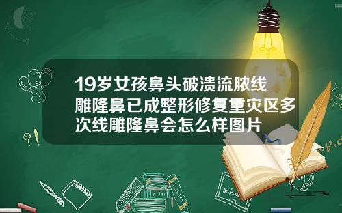 19岁女孩鼻头破溃流脓线雕隆鼻已成整形修复重灾区多次线雕隆鼻会怎么样图片
