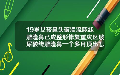 19岁女孩鼻头破溃流脓线雕隆鼻已成整形修复重灾区玻尿酸线雕隆鼻一个多月顶出怎么办