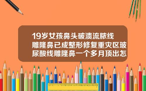 19岁女孩鼻头破溃流脓线雕隆鼻已成整形修复重灾区玻尿酸线雕隆鼻一个多月顶出怎么办