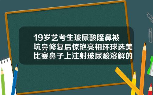 19岁艺考生玻尿酸隆鼻被坑鼻修复后惊艳亮相环球选美比赛鼻子上注射玻尿酸溶解的干净吗