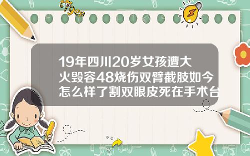 19年四川20岁女孩遭大火毁容48烧伤双臂截肢如今怎么样了割双眼皮死在手术台上