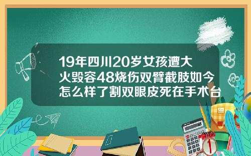 19年四川20岁女孩遭大火毁容48烧伤双臂截肢如今怎么样了割双眼皮死在手术台上