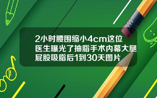 2小时腰围缩小4cm这位医生曝光了抽脂手术内幕大腿屁股吸脂后1到30天图片
